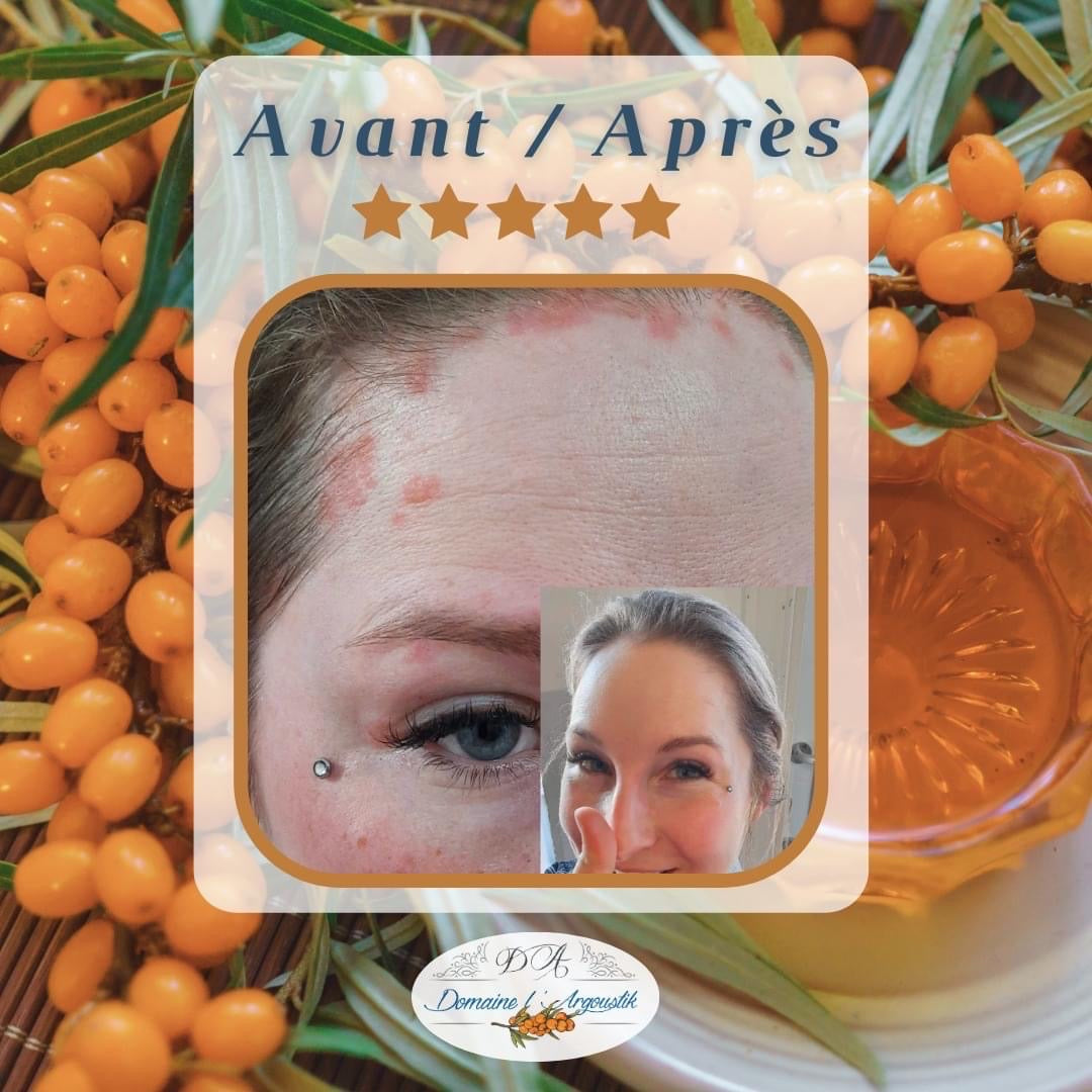 Huile de pépin d'argousier - 30 ml