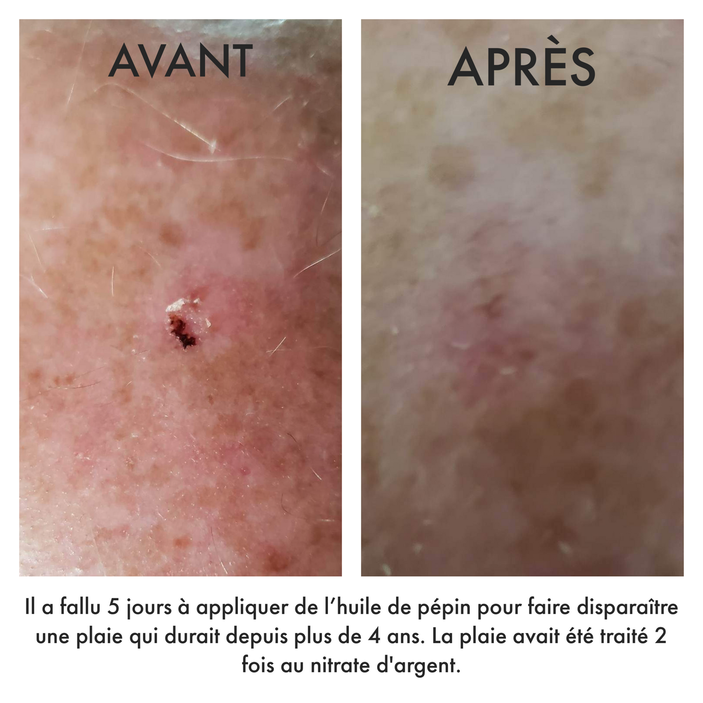 Huile de pépin d'argousier - 30 ml