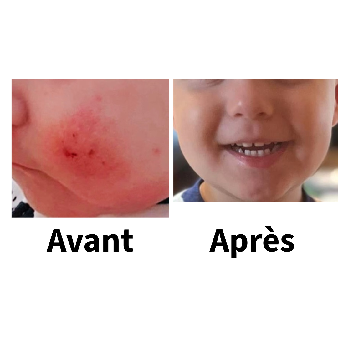 Huile de pépin d'argousier - 30 ml